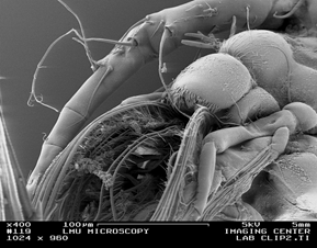 Mouthparts of the calanoid copepod, Labidocera. Maxilla 2 “fingers” are pushing food into the mouth located under the labium, just posterior of the labrum