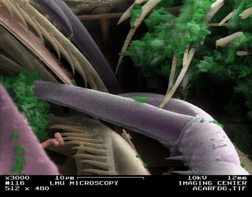 Colorized SEM of the cyclopoid copepod, Acartia. maxillae (beige) placing food (green) into the mouth. Pincers (purple) are used for feeding and maxillae grooming. Note the skewered bacteria (pink) at the bottom left of the image. Colorization by D. Allio.